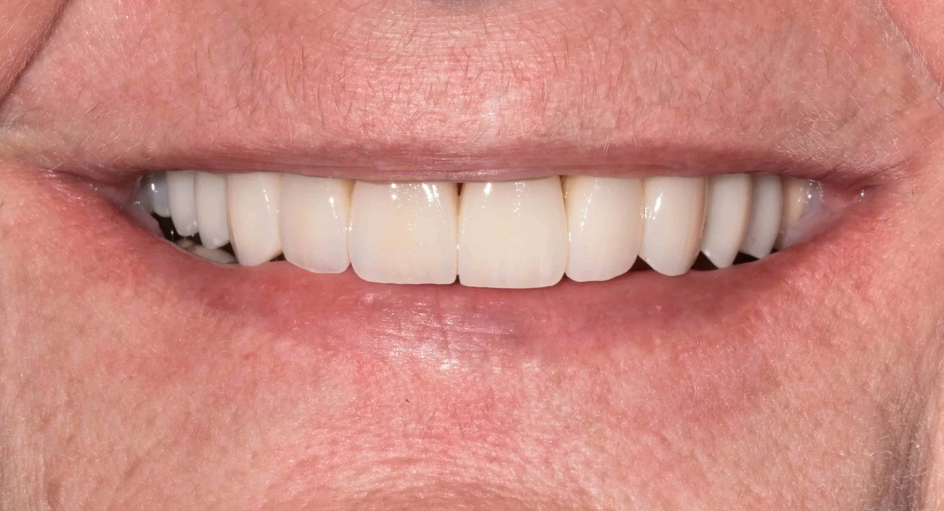 Close-up-final-smile-min-1920w