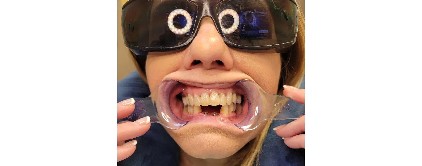 Serrano+before-1920w