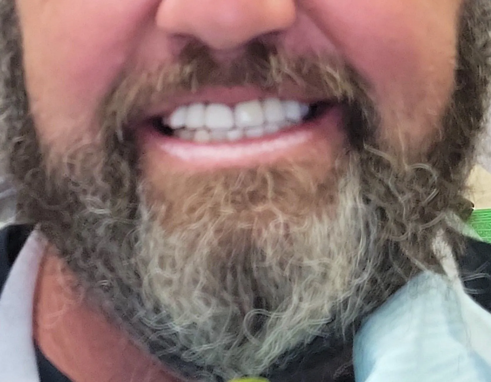 ballard+before-1920w