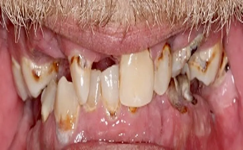 before-all-on-x-min-1920w