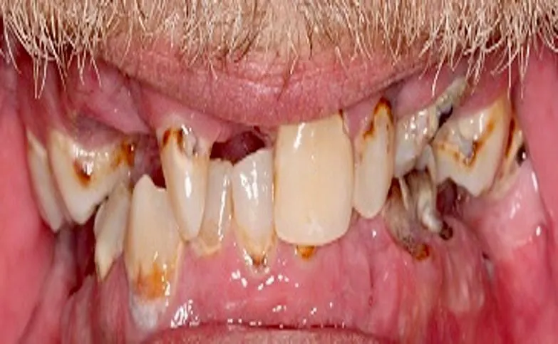 before+all+on+x-88a30574-1920w