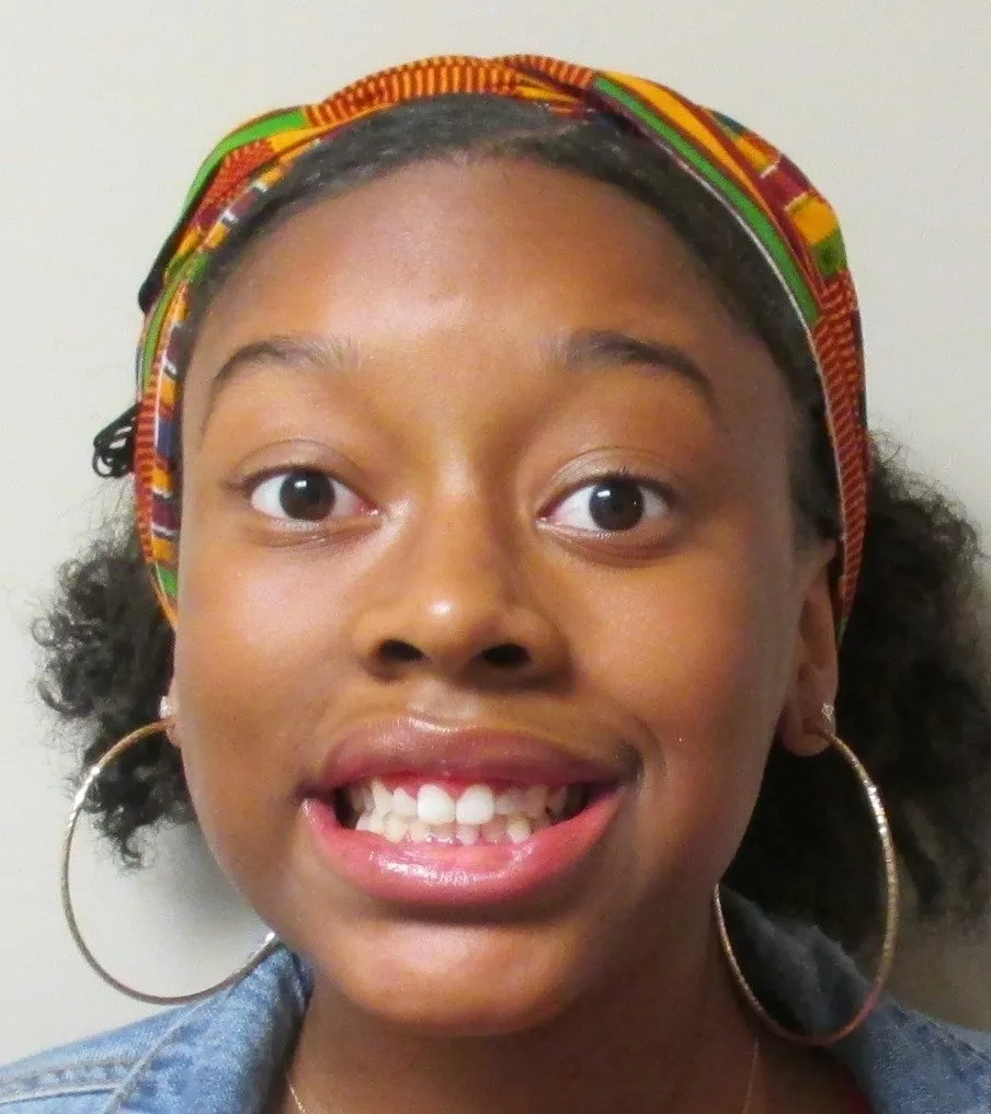 erin-sills-post-op-(facial)-min-1920w