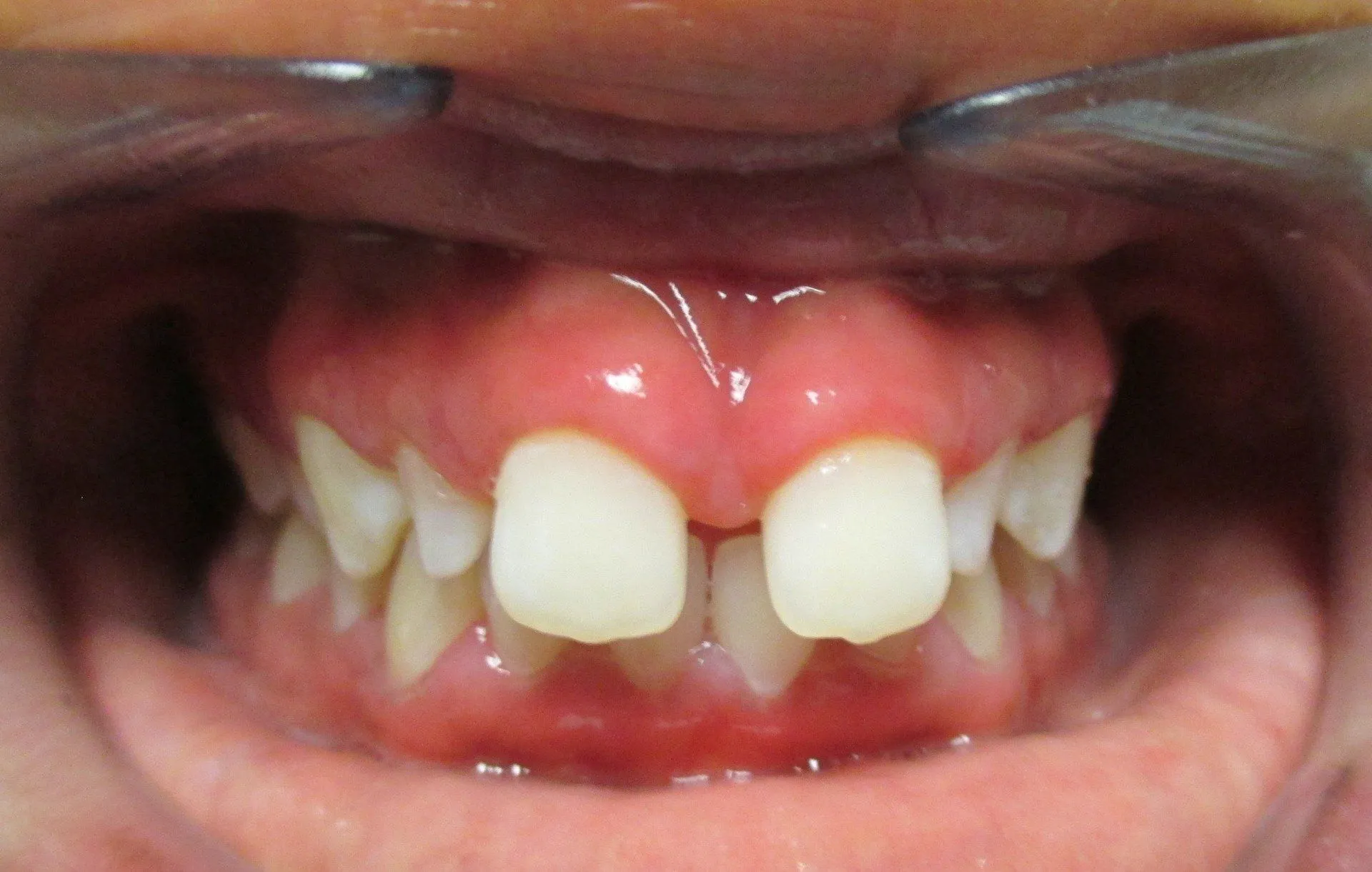 erin-sills-pre-(MI)-67cdc231-1920w-1920x1220-min-1920w