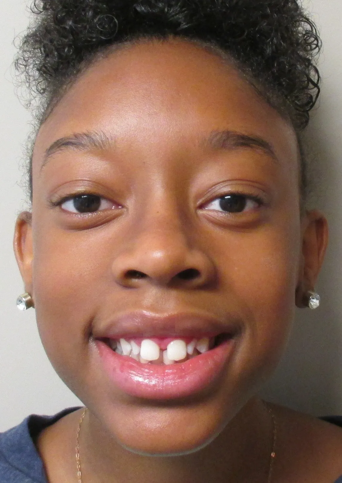 erin-sills-pre-(facial)-min-1920w