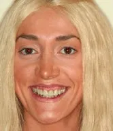 nova-before-after-2-b411dbd8-min-1920w