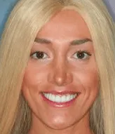 nova-before-after-2-fcda424a-min-1920w