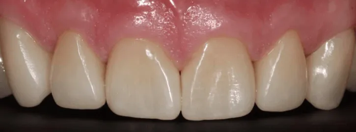 post-.-071a0358-min-1920w