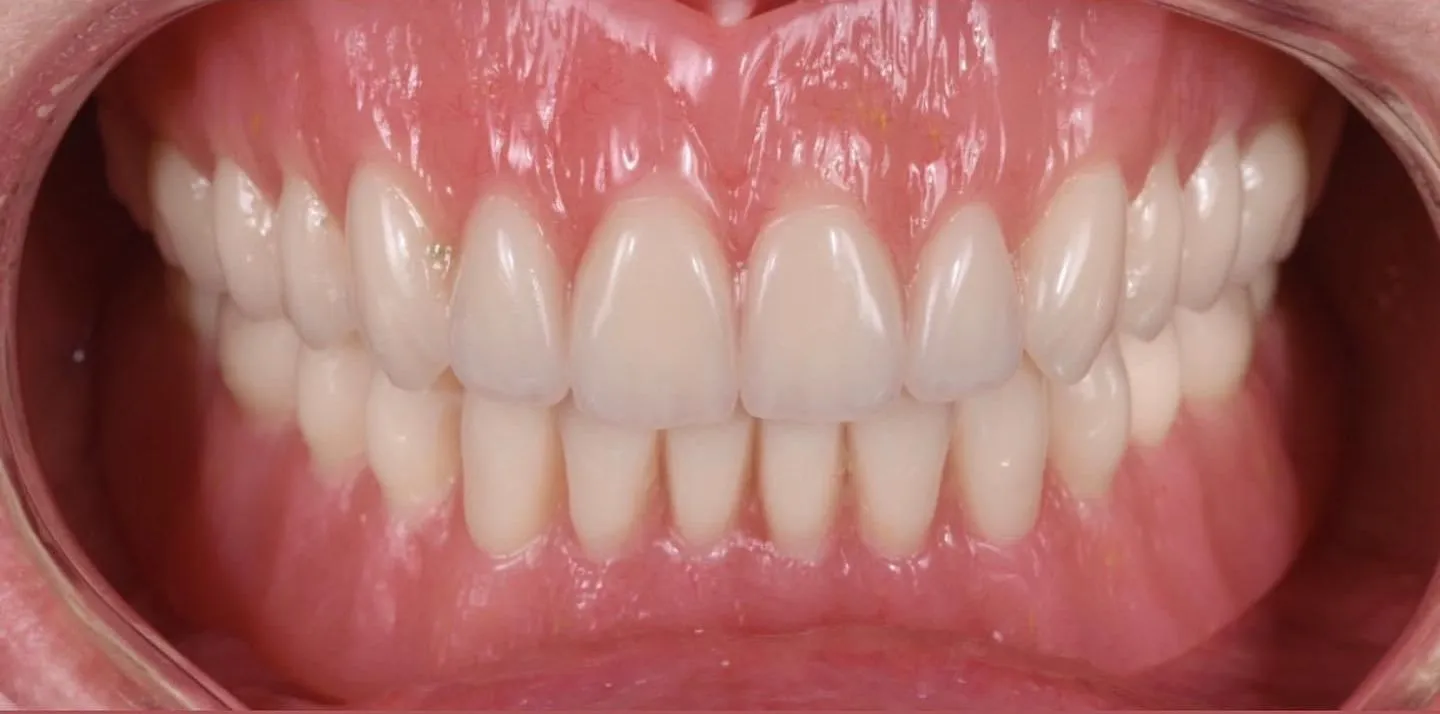 pre-post-1-d840c46d-1920w