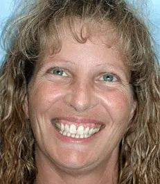 severe-spacing-1-ef1edeb5-min-1920w