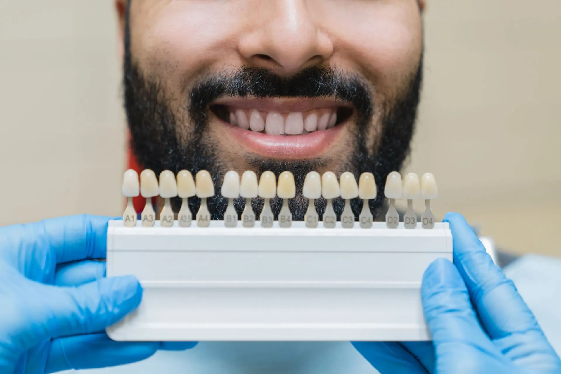 Best Type of Dental Veneers – The Different Types of Veneers