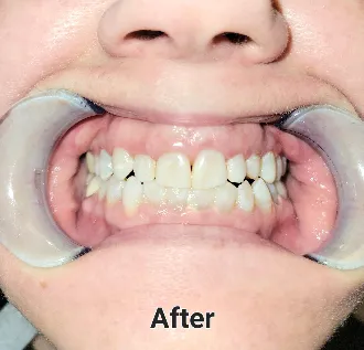 Waldman-after-32c9b3ab-1920w