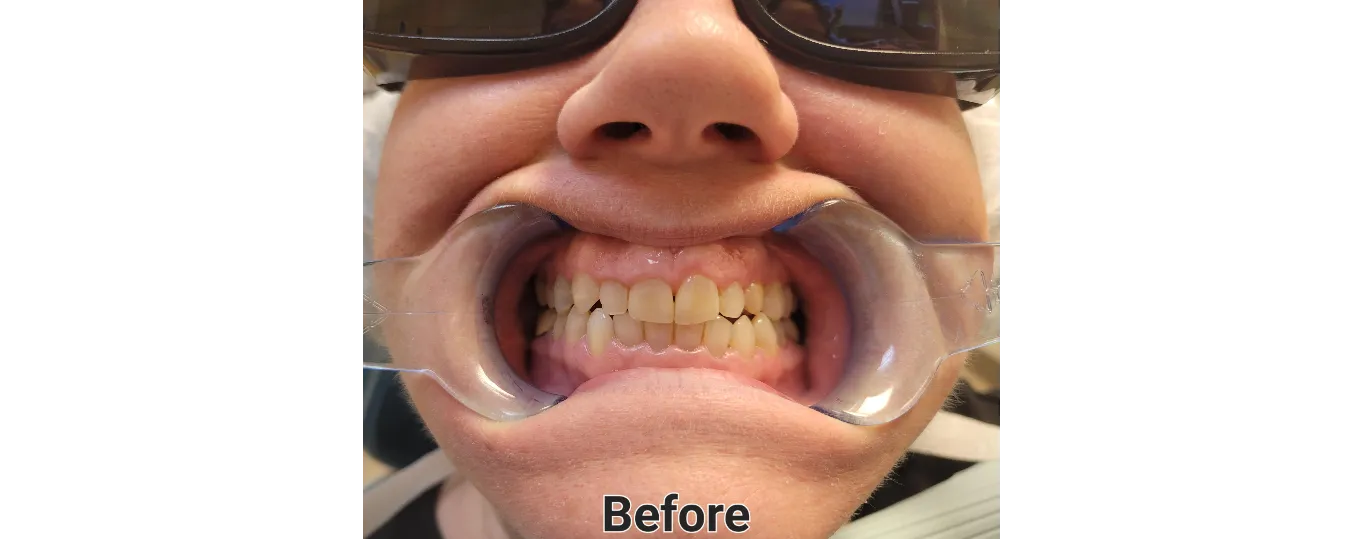 Waldman-before-1920w